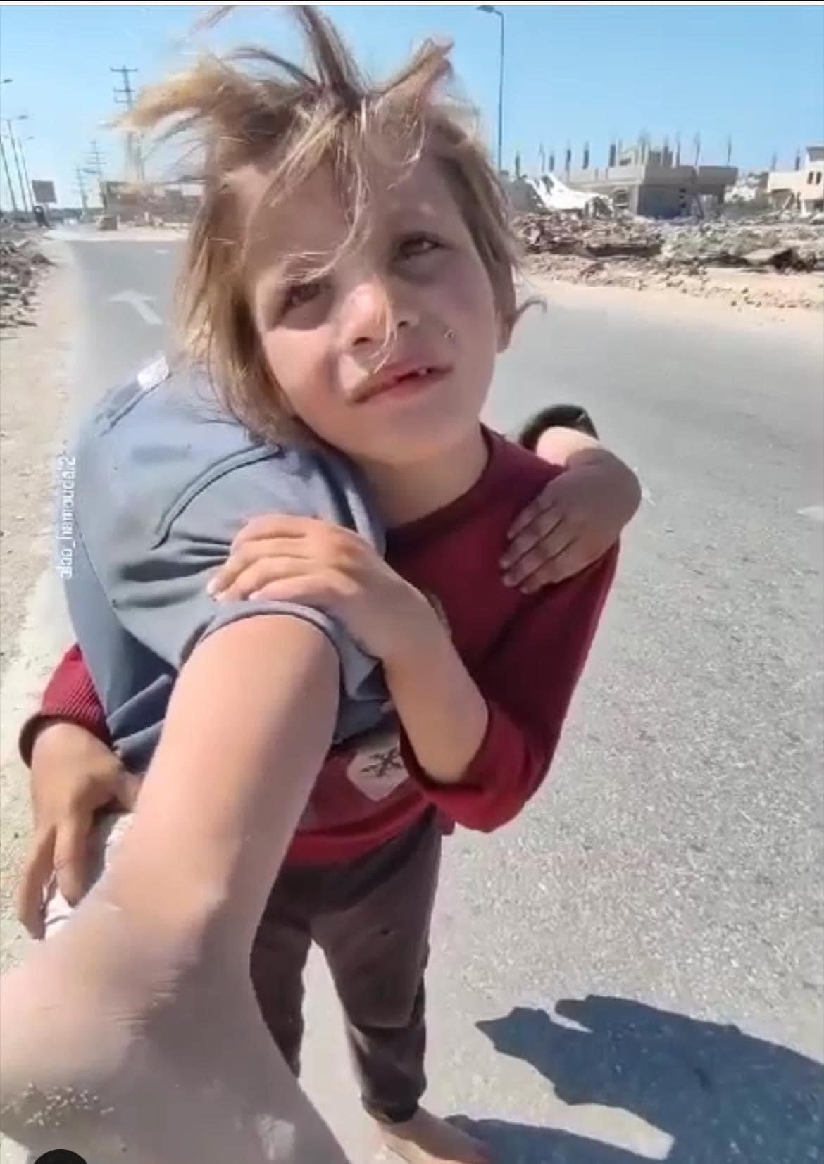 Viral: Barefoot Girl Carries Injured Sister on Her Back