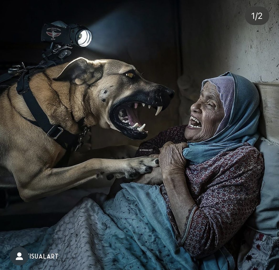 Gazan Woman Narrates Ordeal as Israeli Army Dog Attacks Her