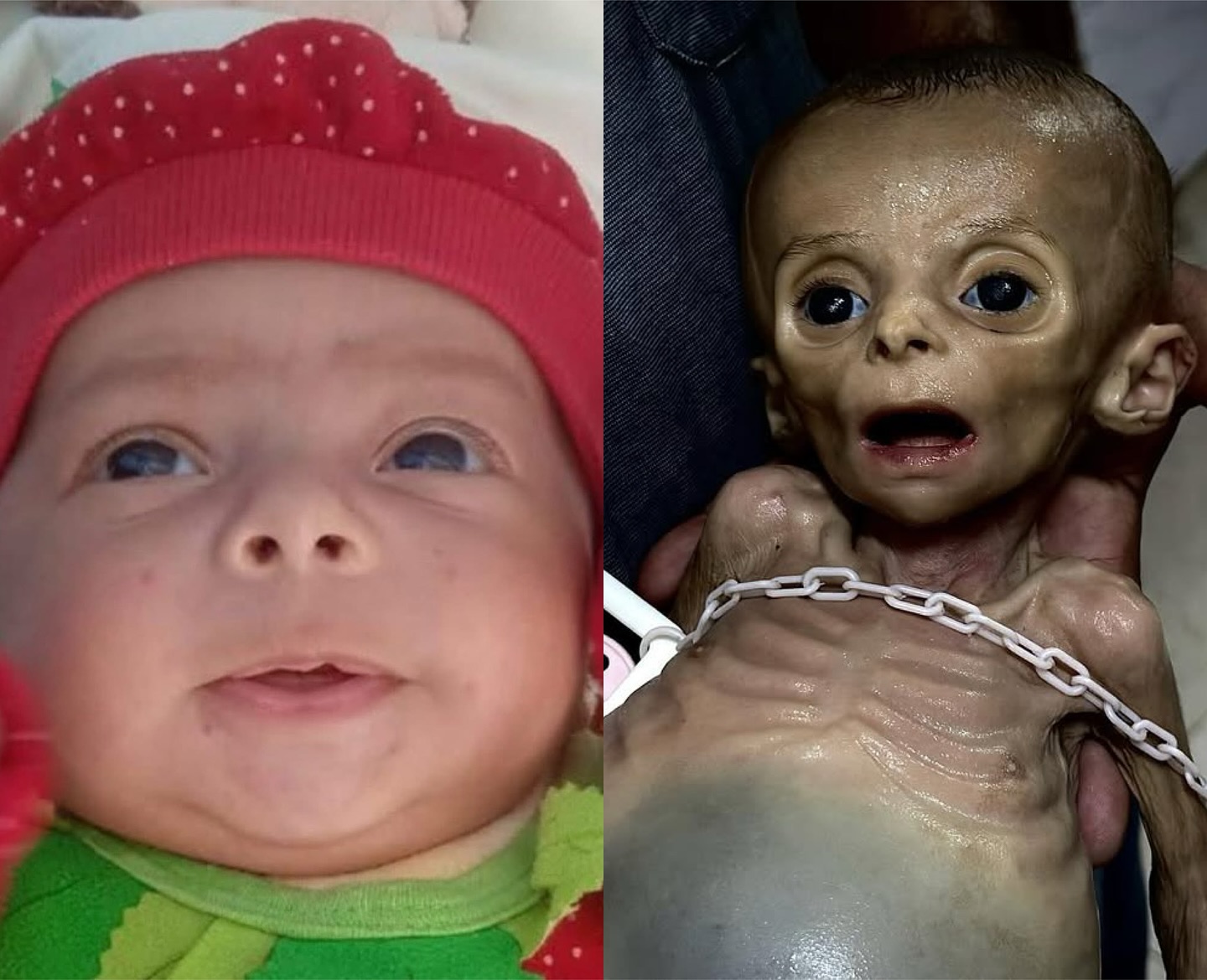 Airdrops No Solution to Starvation