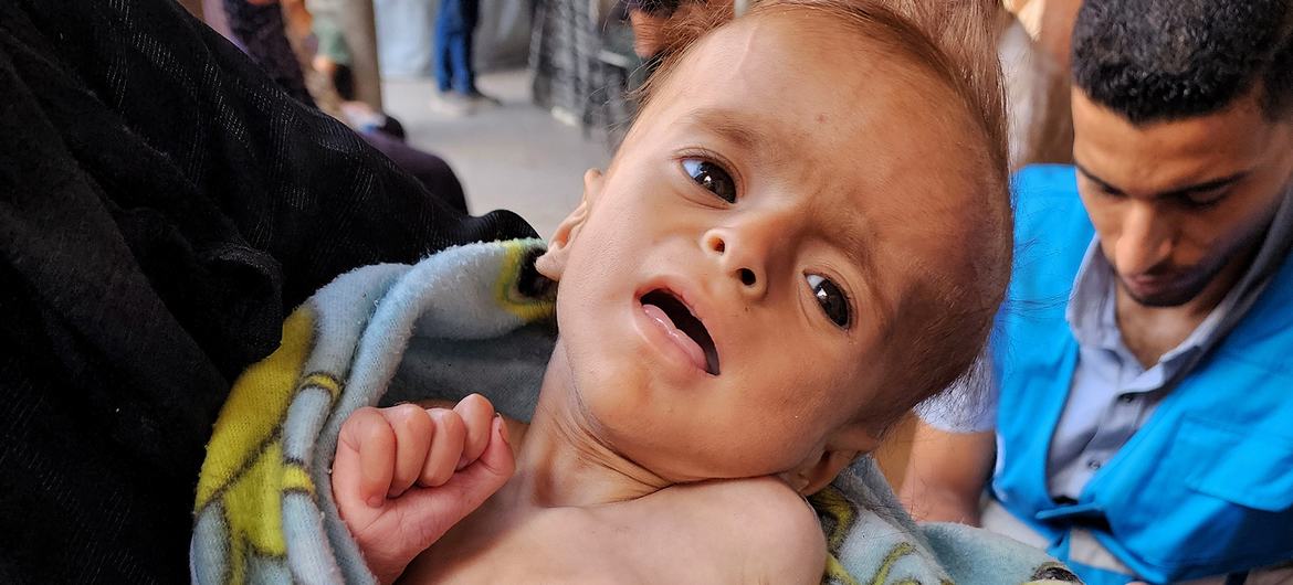 Starvation in The Gaza Genocide