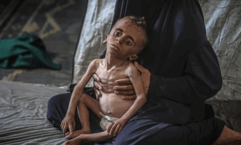 Stop Weaponizing Food – 100 NGOs Tell Israel