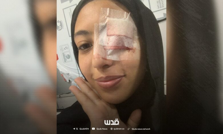‘When Israel Stole My Eyes…’