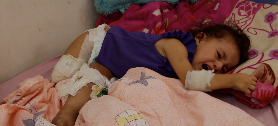 Ugly War: Amputating The Palestinians?