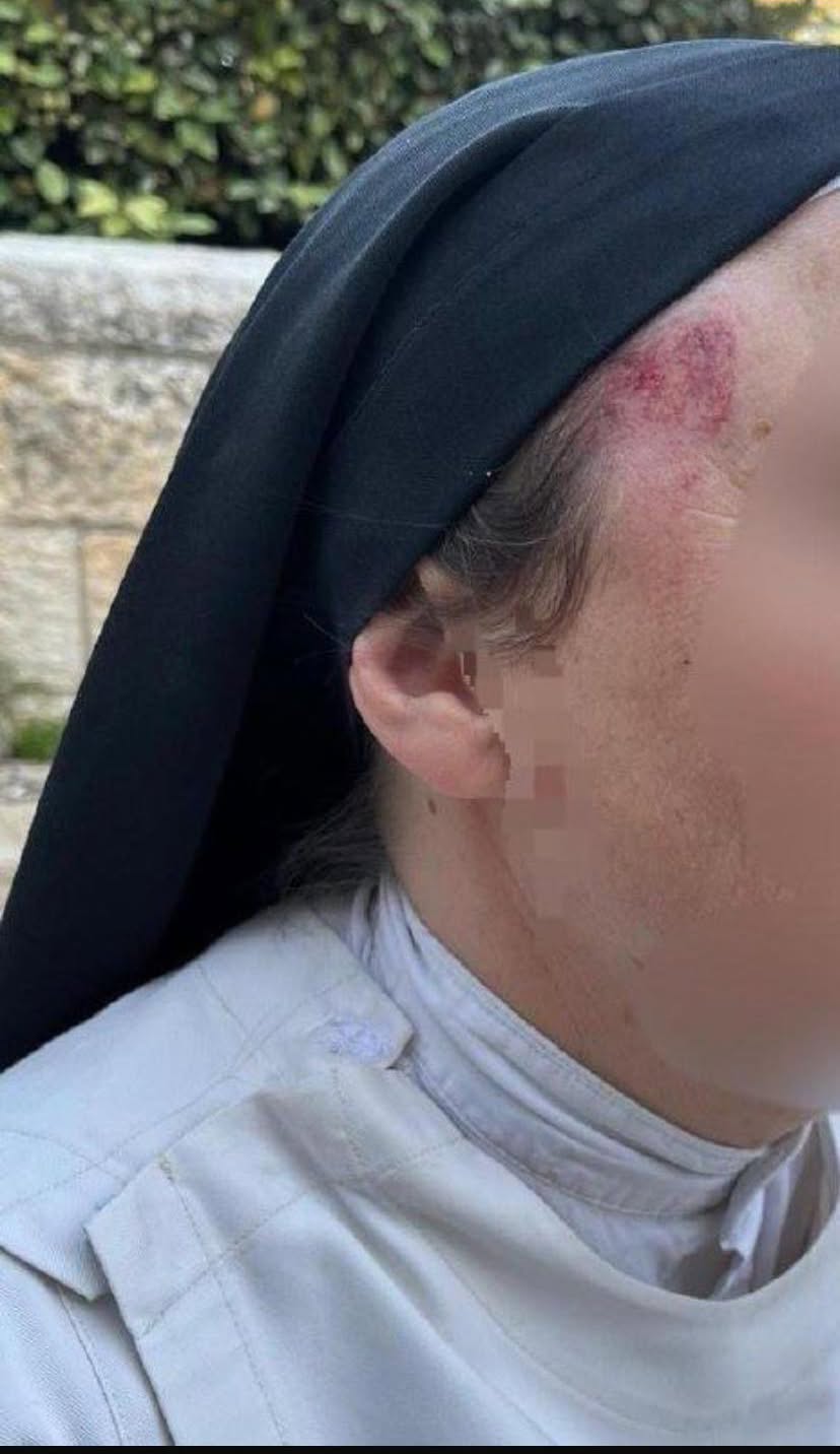 Israeli Attacks on Christians Spike to 88 Cases