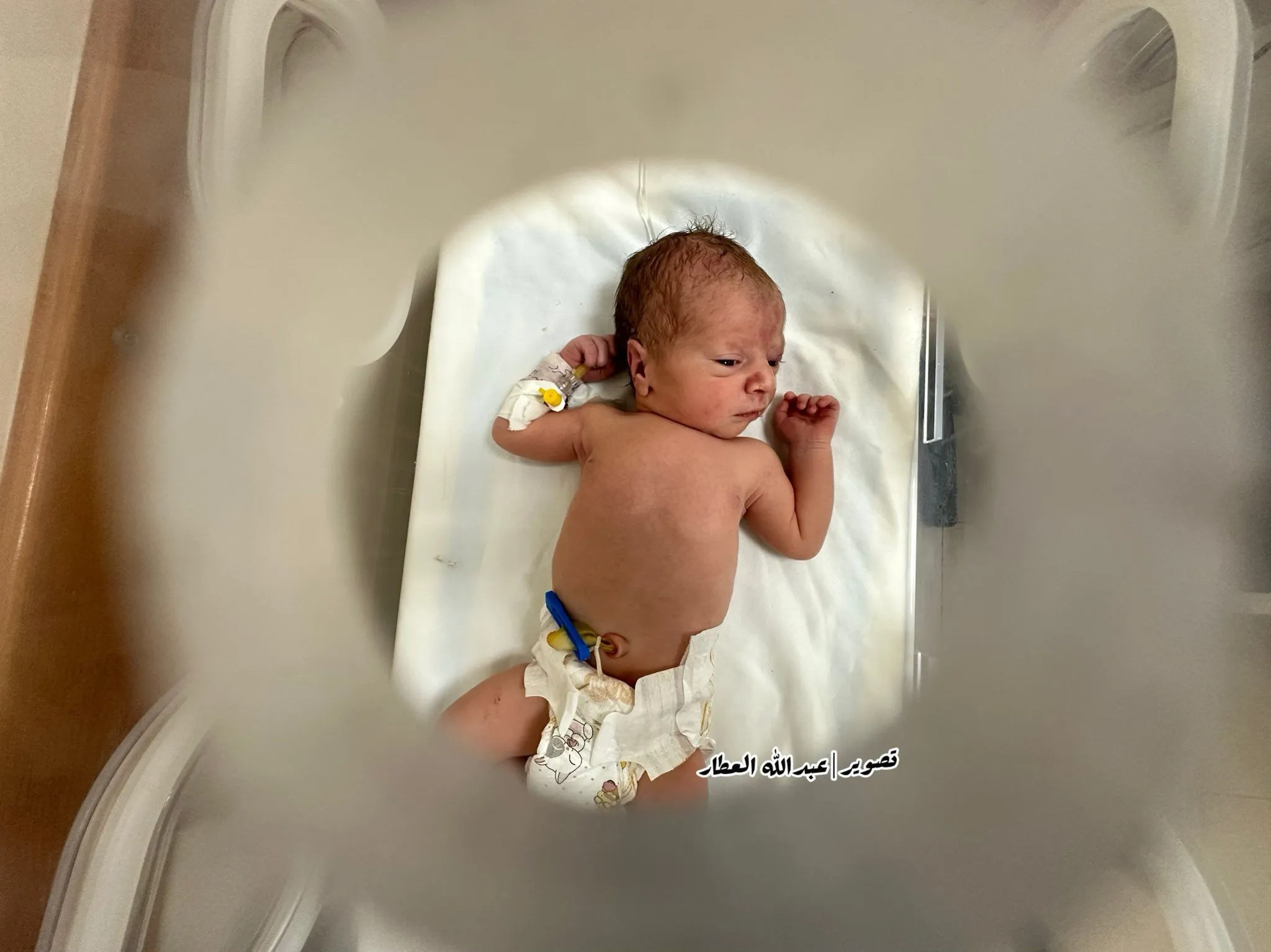 Revisited: The ‘Miracle Baby’ Story